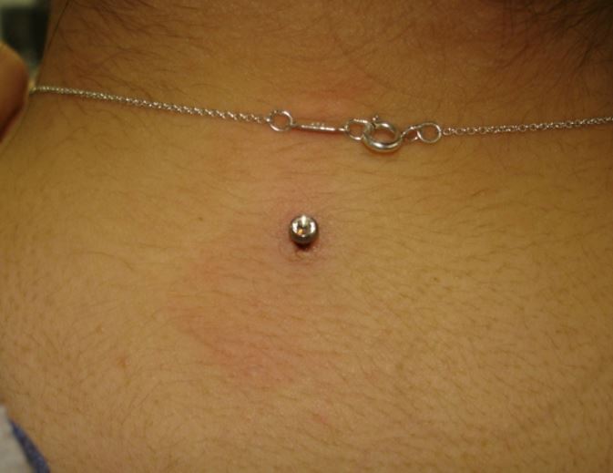 piercing neck microdermal singolo